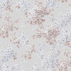 PL72651-14 